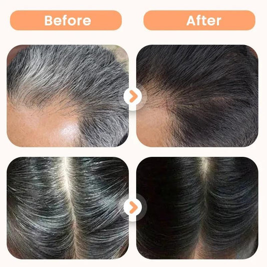Plant Extract Hair Dye for Gray Hair 200 ml (Pack of 2)